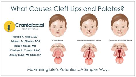 ceift|CEFIT .